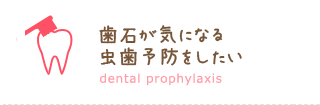 歯石が気になる 虫歯予防をしたい